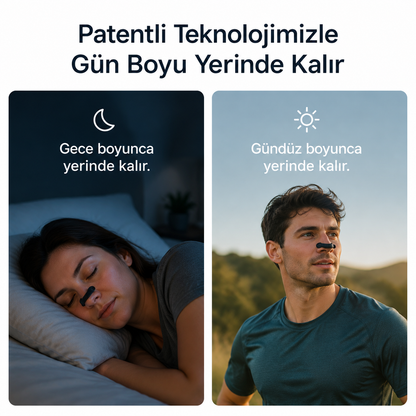 Elimest Manyetik Burun Bandı Seti 30'lu